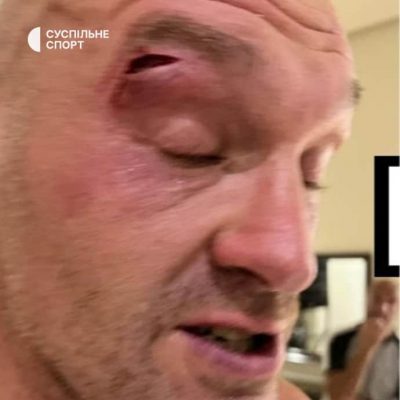 Бой Усика с Фьюри отложили за две недели до поединка из-за травмы британца &ndash; СМИ 
