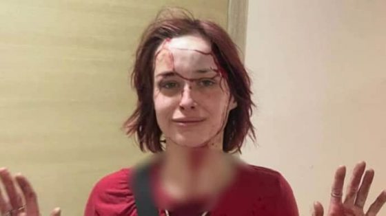 ОК ''Юг'' назвало ''работой на врага'' видео с избиением девушки представителем ТЦК 3 ok jug nazvalo rabotoj na vraga video s izbieniem devushki predstavitelem tck 89af15a scaled China Way