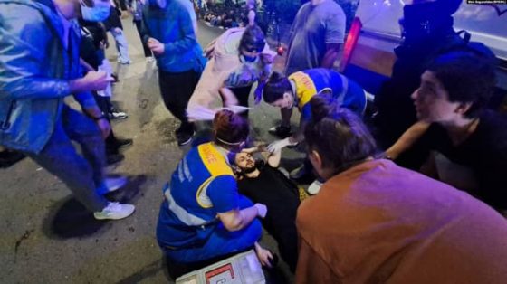 В Тбилиси госпитализировали восемь демонстрантов – СМИ 14 v tbilisi gospitalizirovali vosem demonstrantov smi 3aa95f7 scaled China Way
