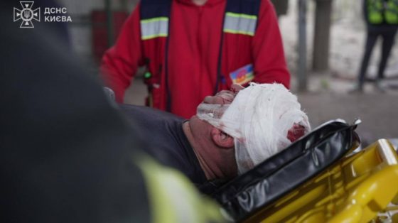 ubity medsestra i pacient eshhe 70 chelovek raneny glava mvd o posledstvijah rossijskoj ataki 9d79eb2 scaled China Way